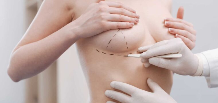 The Best Breast Implants for You