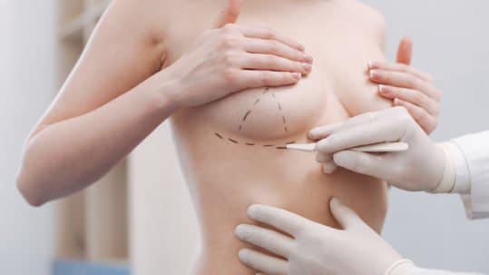 The Final Touch: What to Expect from Nipple Reconstruction Surgery